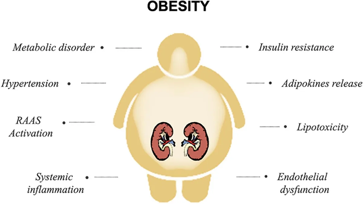 Adolescent Obesity: A Significant Risk Factor for Early Chronic Kidney Disease