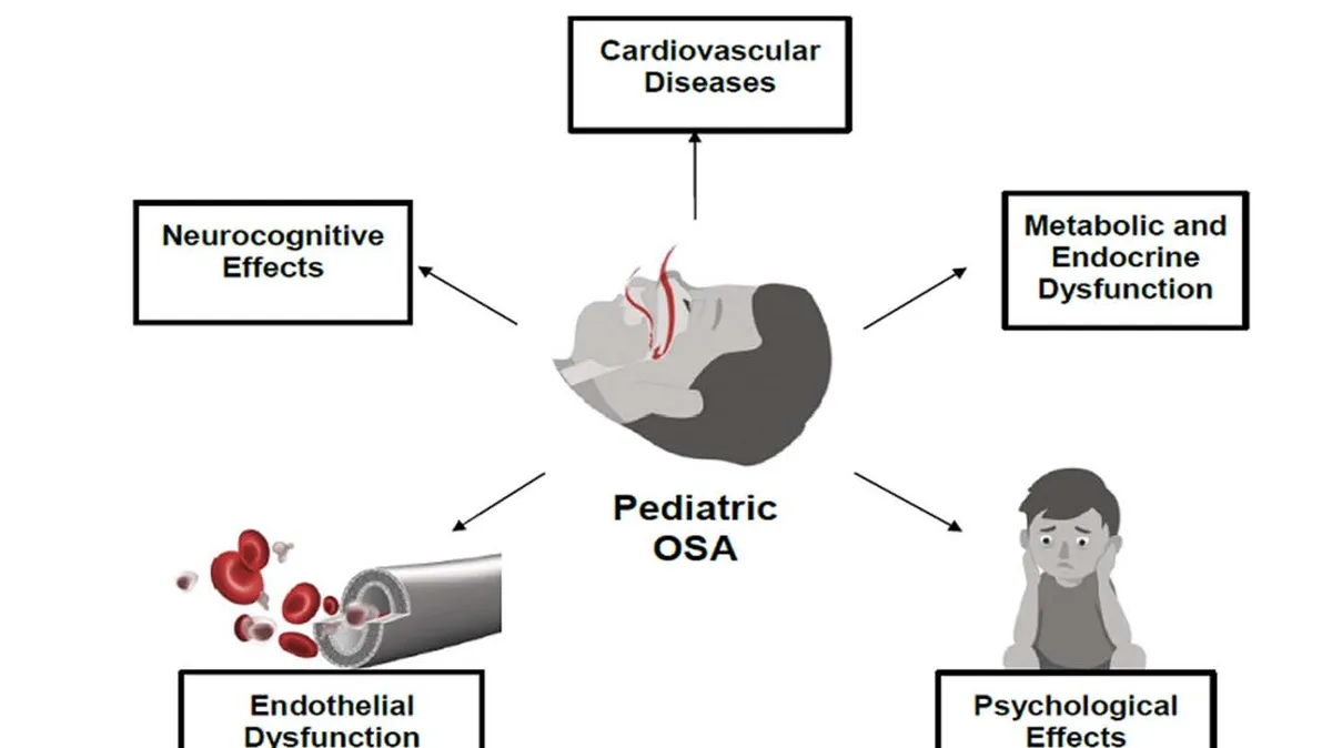 The Complexities of Evaluating and Treating Obstructive Sleep Apnea in Children