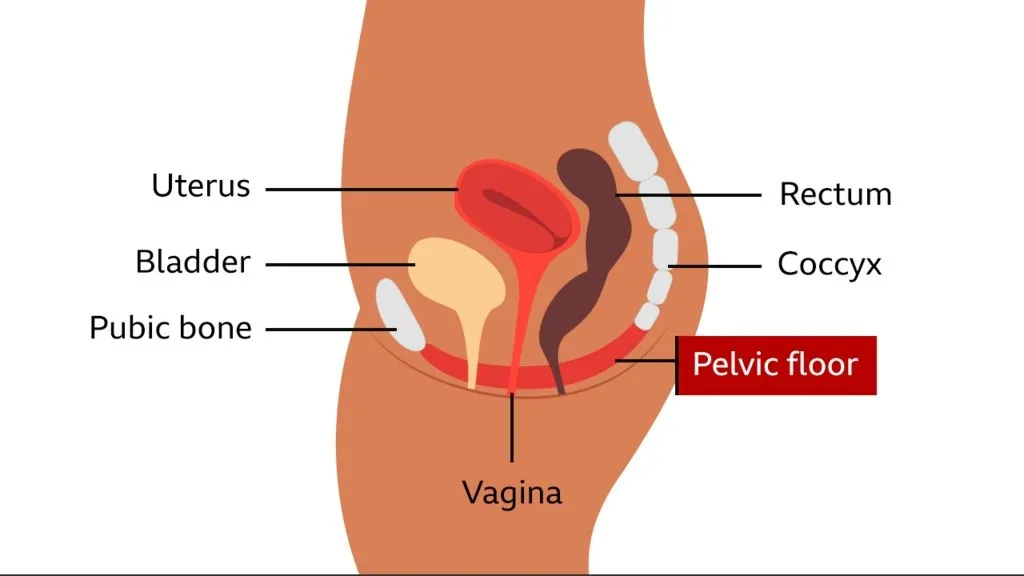 Understanding and Addressing the Sensation of a Bulging Lump in the Vagina