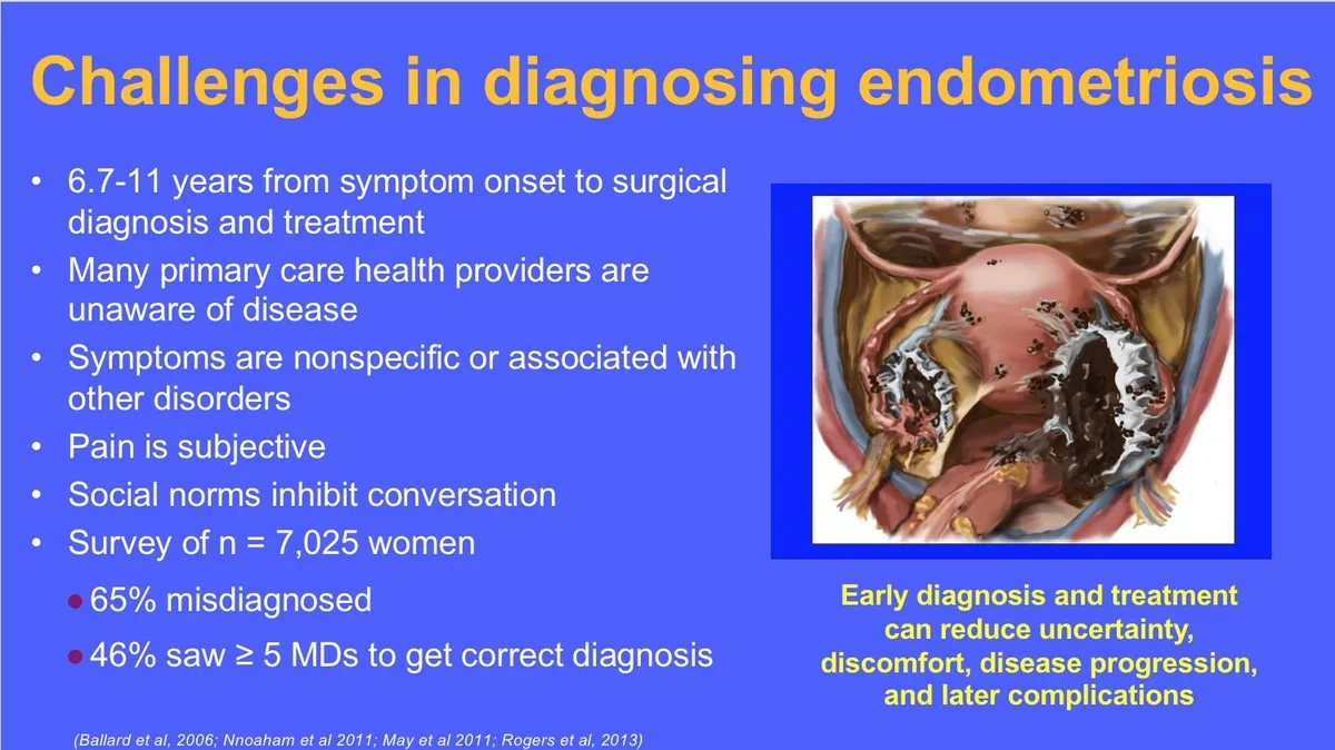 Challenges and Barriers in Endometriosis Care: The Need for Change
