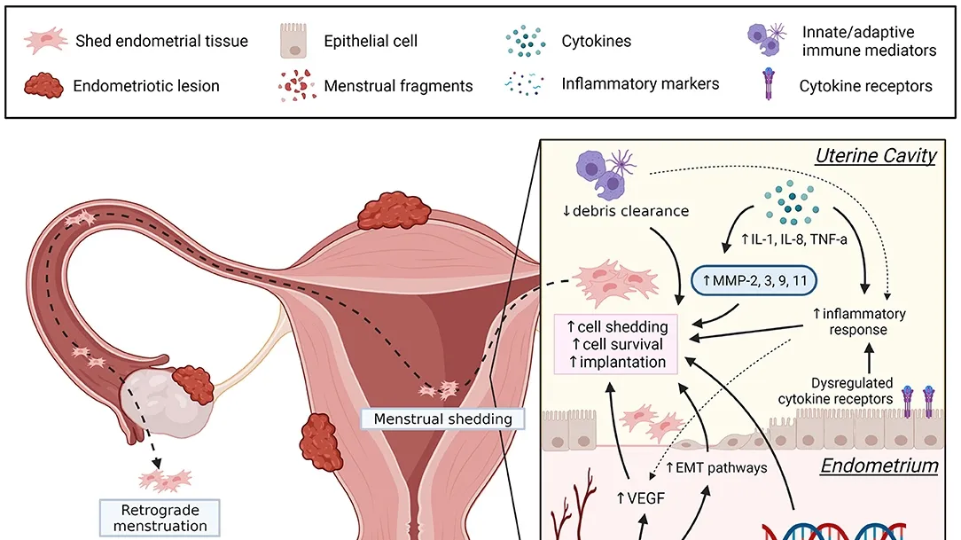 Emerging Research on Endometriosis: Dietary Insights, Diagnostic Tools, and Potential Treatments