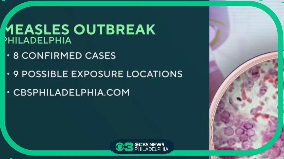 Understanding the Recent Measles Outbreak in Philadelphia and the Importance of Vaccinations