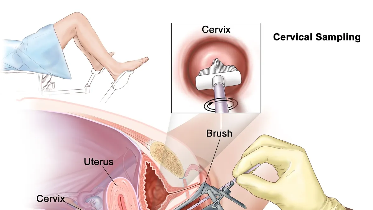 The Importance of Regular Pap Smears in Cervical Cancer Prevention