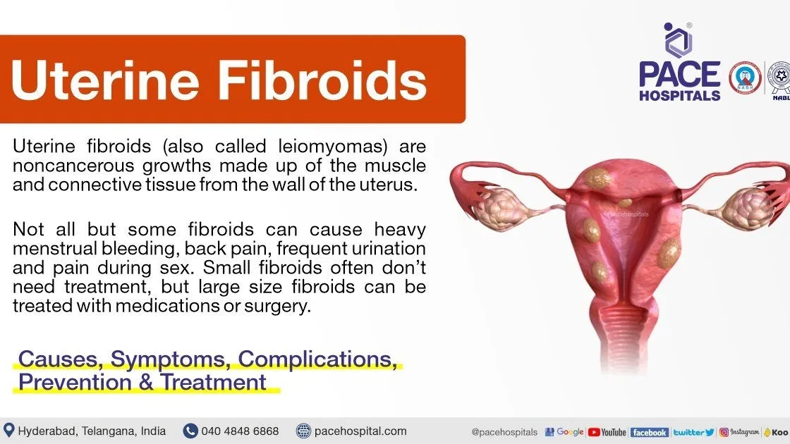 Understanding the Symptoms and Treatment Options for Uterine Fibroids