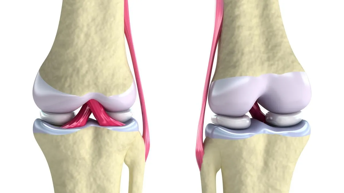 3D-Printed Cartilage: A Revolutionary Approach in Regenerative Medicine