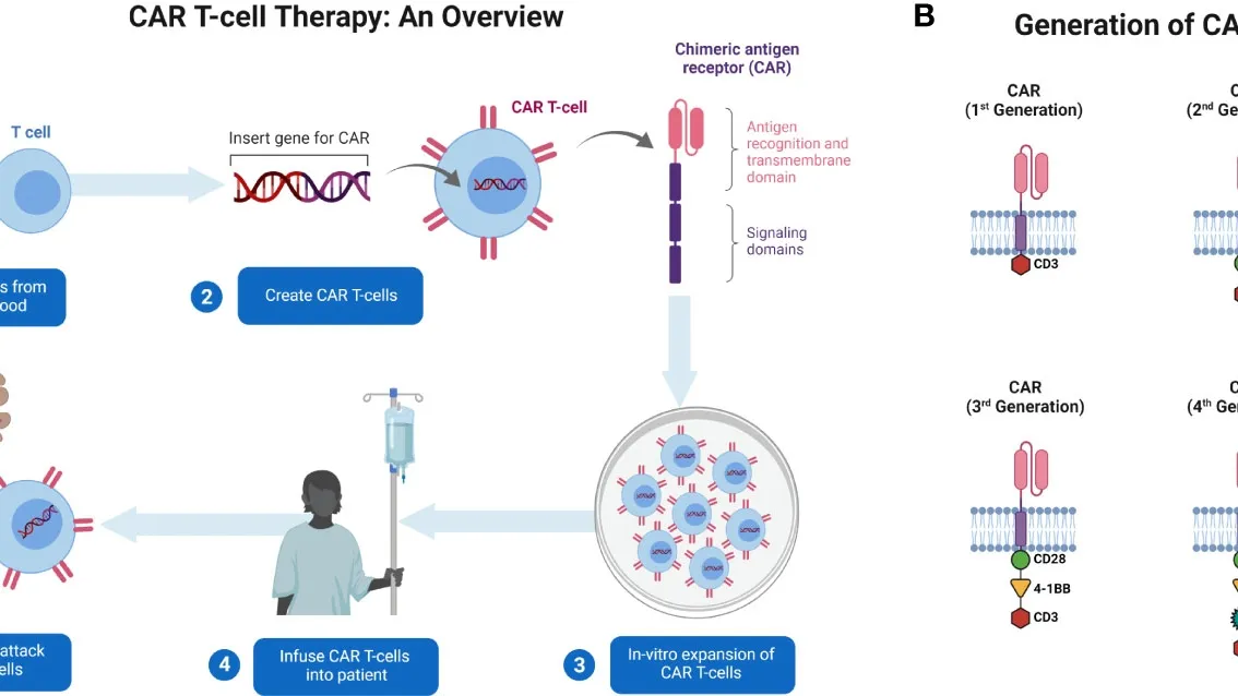 Tackling Aggressive Lymphomas: The Future of CAR T Cell Therapy