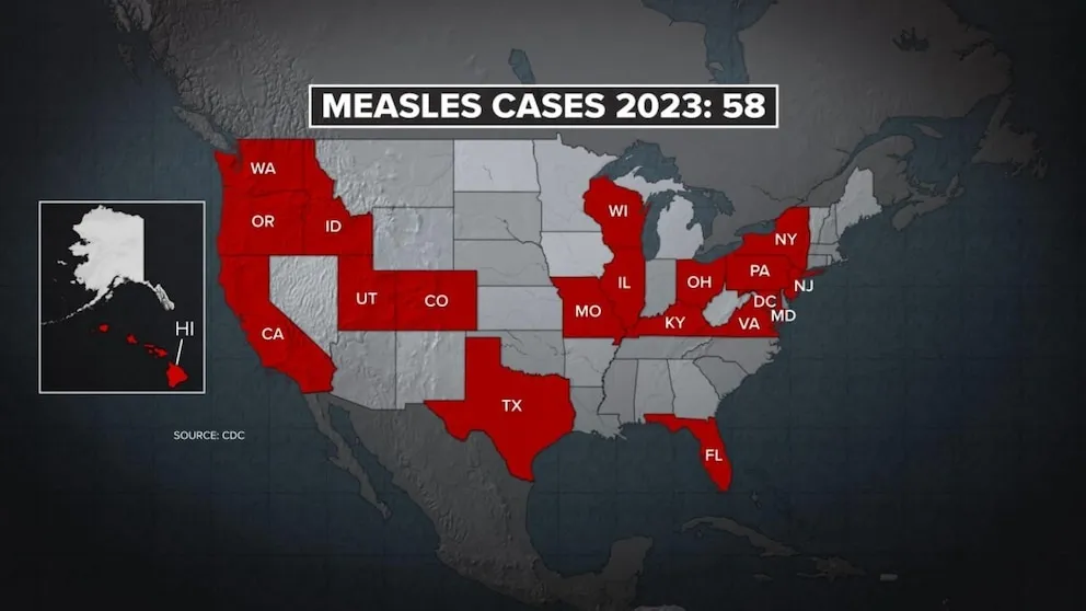 Rising Measles Cases in the U.S. Sparks CDC Alert: The Importance of Vaccination