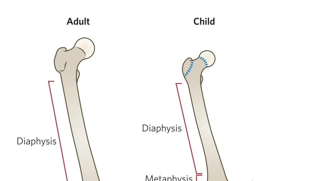 Understanding and Managing Childhood Bone, Muscle, and Tendon Injuries