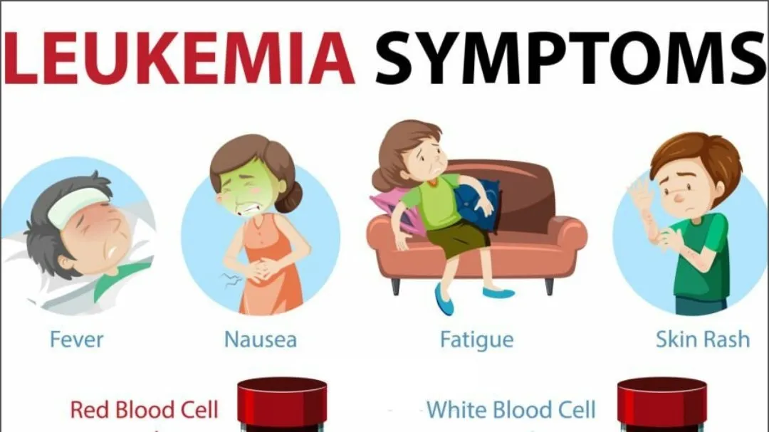 Understanding and Addressing Childhood Leukemia: Symptoms, Risk Factors, and Treatment Options