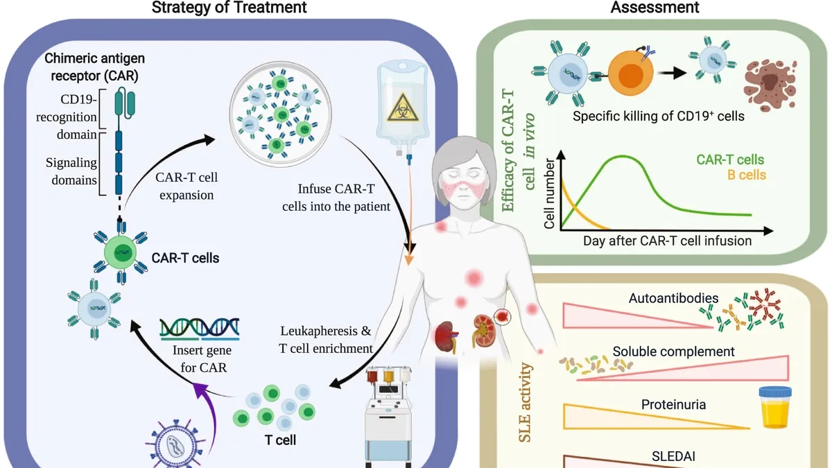 Chimeric Antigen Receptor T-cell Therapy: A Potential Game-Changer in Lupus Treatment