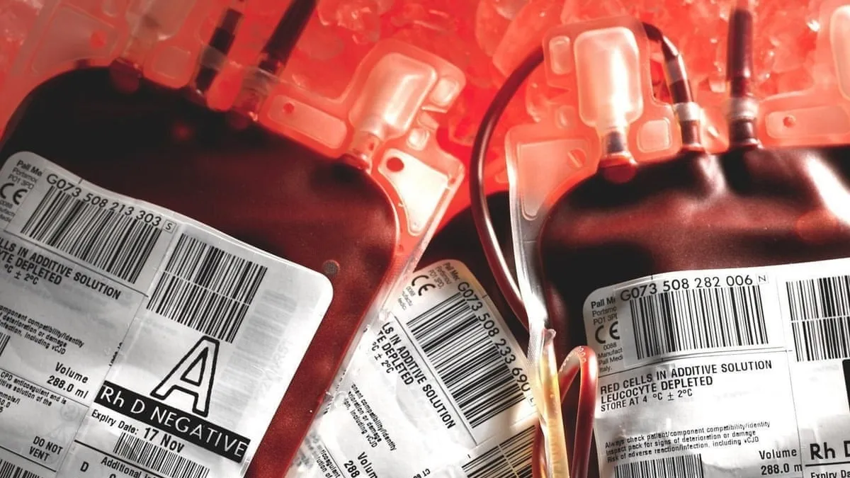 Factor VIII Controversy: A Tragic Tale of Contaminated Blood Products and Haemophilia Patients in the UK