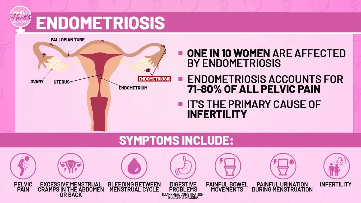 Shining a Spotlight on Endometriosis: Closing the Women’s Health Gap