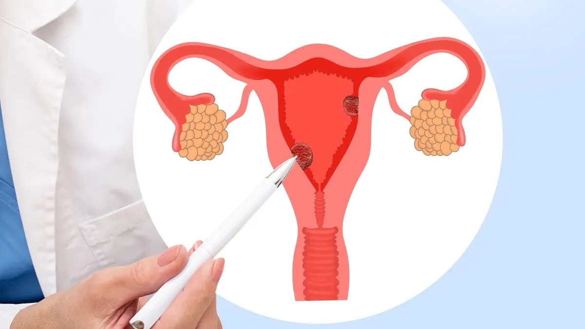 Understanding the Genetic Regulation of Estrone Levels and Endometrial Cancer Risk in Postmenopausal Women