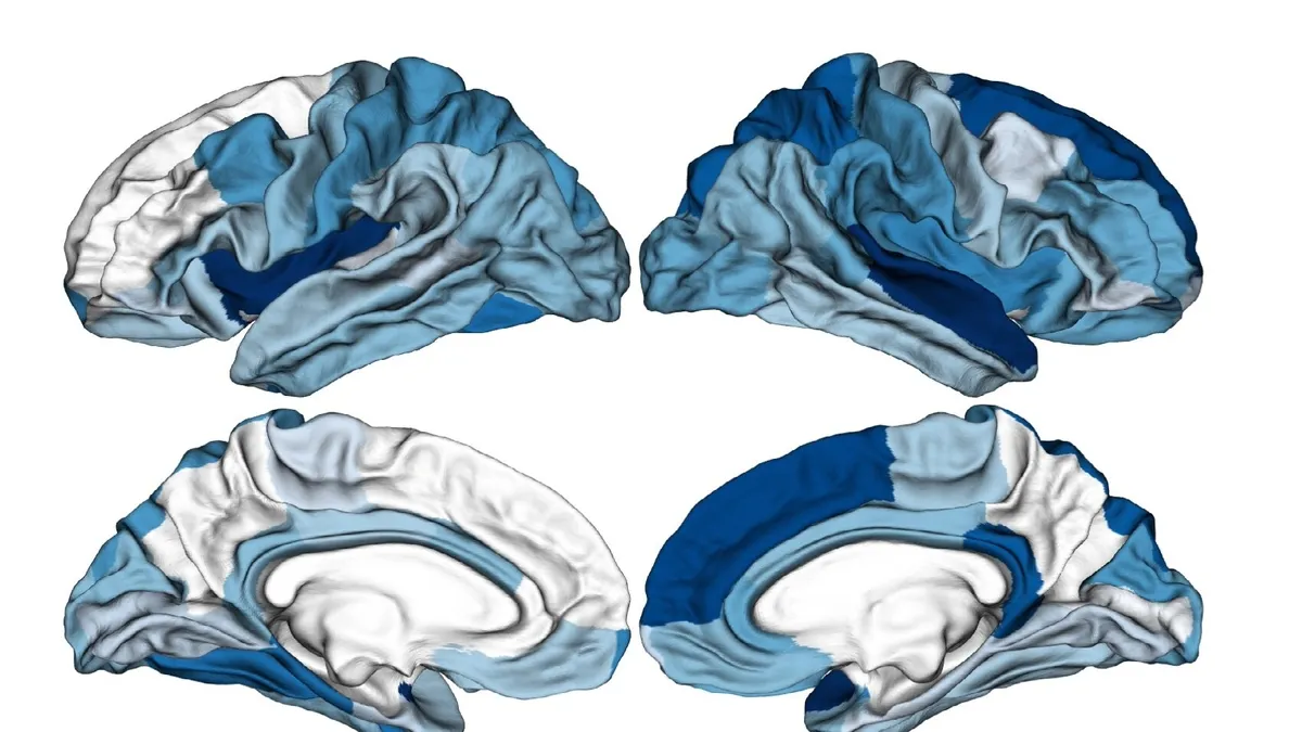 Predicting Psychosis Onset: The Power of Machine Learning and MRI Scans