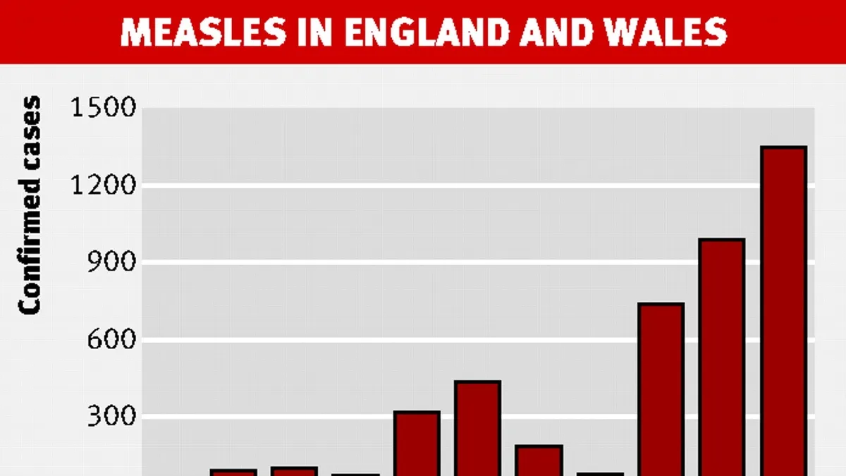 Rising Measles Cases in England: A Call for Increased Vaccination Measures