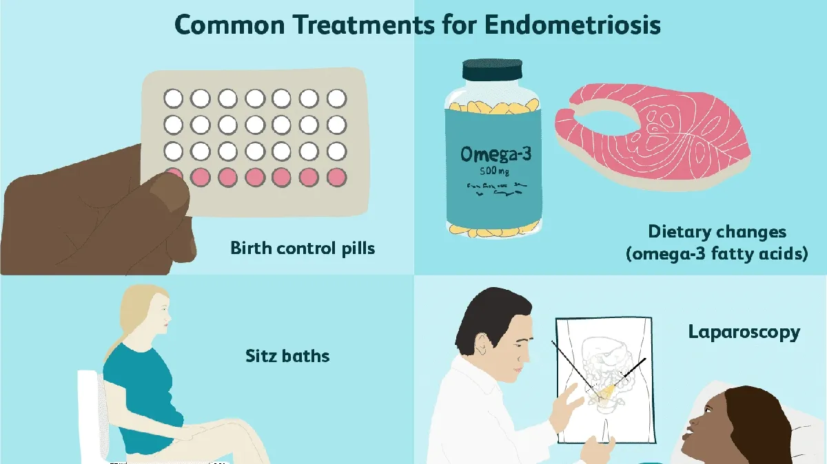 Emerging Non-Hormonal Treatment Strategies for Endometriosis