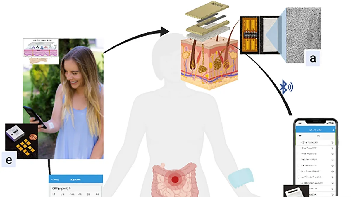 Revolutionizing Disease Monitoring: A Wearable Device That Tracks IBD from Sweat