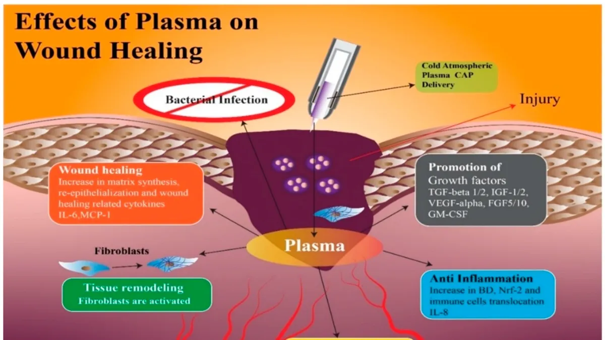 Revolutionizing Chronic Wound Care with Plasma-Activated Hydrogel Dressings