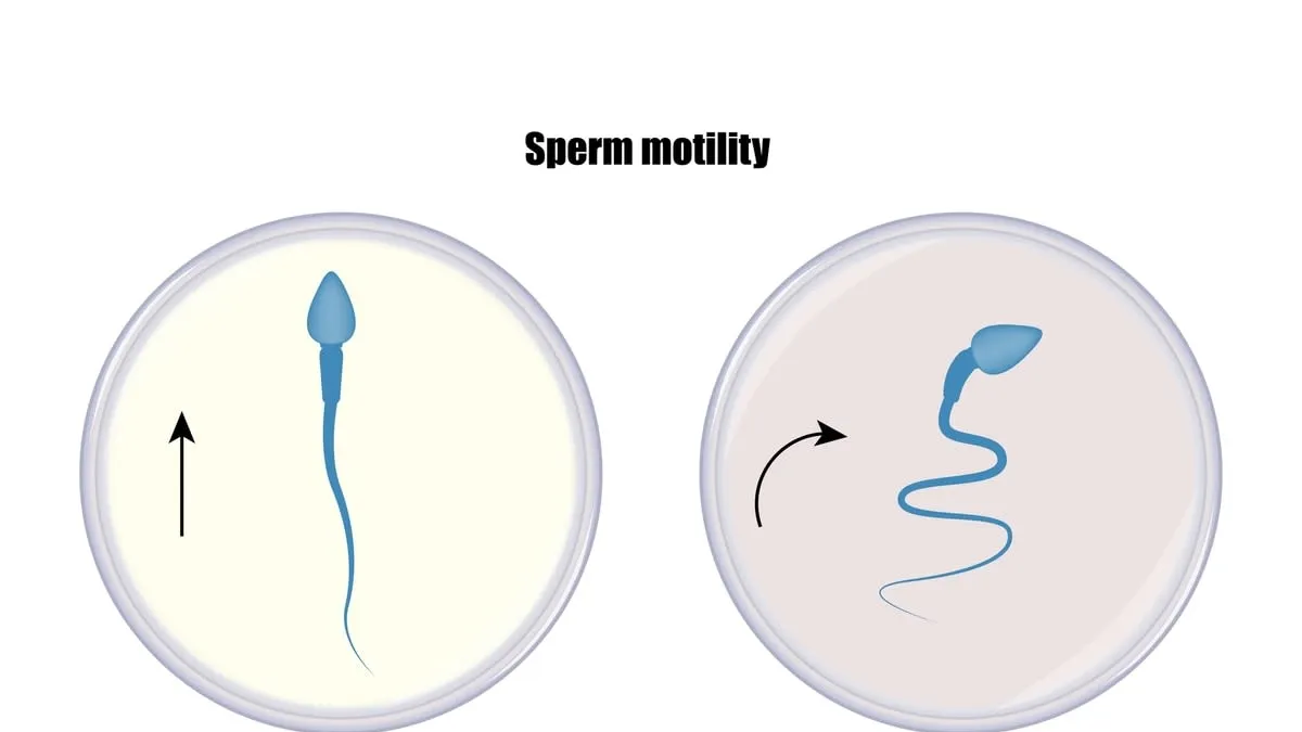 Ultrasound Waves: A Revolutionary Approach to Boosting Sperm Motility and Enhancing IVF Success