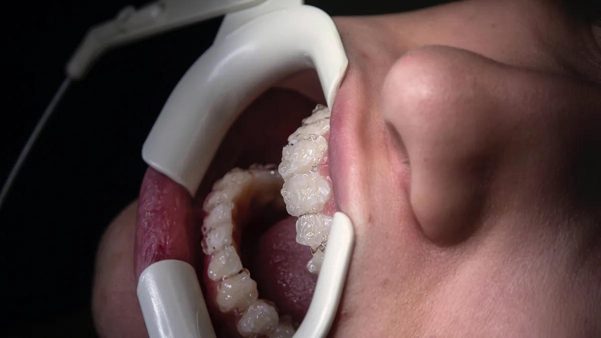 Revolutionizing Dental Care: Tissue Regeneration- The Future of Root Canal Treatments