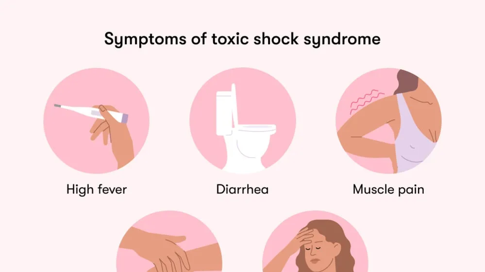 Understanding Toxic Shock Syndrome: A Potential Life-Threatening Condition