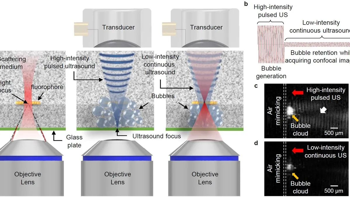 Breakthroughs in Ultrasound-Induced Luminescence Imaging: Promising Innovations in Health Diagnostics