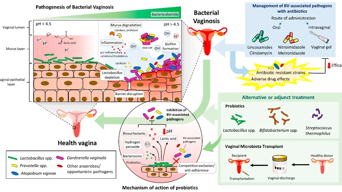 The Role of the Vaginal Microbiome and Probiotic Therapy in Women’s Health